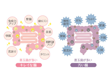 腸活ダイエットにおすすめな食べ物とは 痩せ菌を増やす食事 食材まとめ